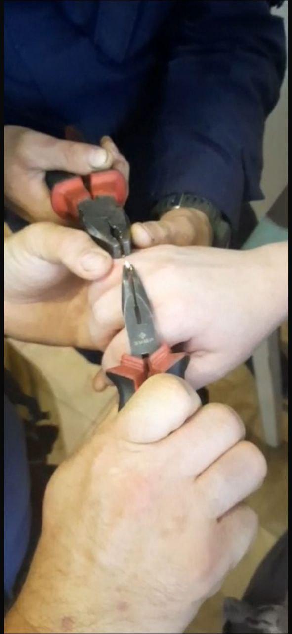 Кольцо с пальца беременной орловчанки пришлось снимать при помощи инструментов