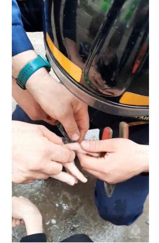 Спасатели помогли орловскому подростку освободить застрявший палец